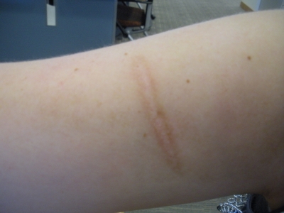 The Callouses on our Hands.JPG