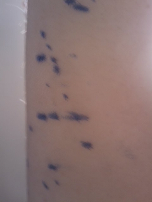 This is what happens when you don't put the cap back on your pen.