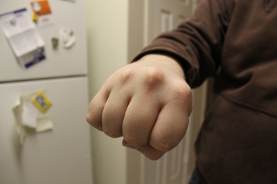 My delightfully messed-up hand. :D