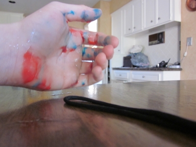 raynaud's.