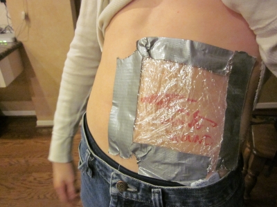 in case of evisceration, apply saran wrap. in case of evisceration, apply saran wrap.
