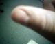 My thumb