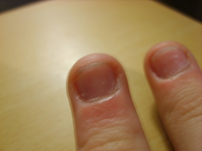 Nails: progress