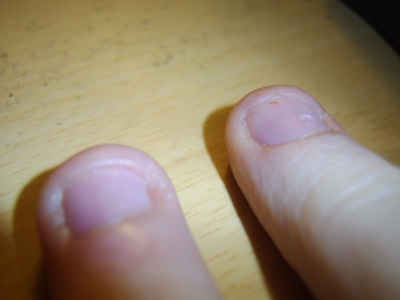 Nails #1