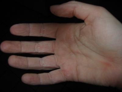 Prune-hand!