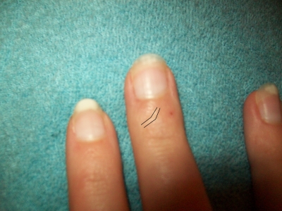 Scar Scar