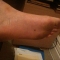 The Callouses on Your Hands by That Guy The Callouses on Your Hands by That Guy