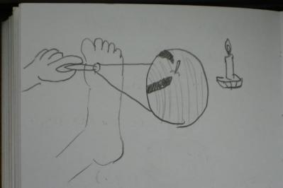 Surgery.JPG