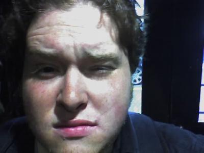 My Face Hurts