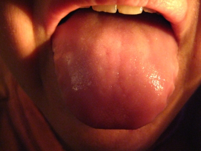 Taste Buds