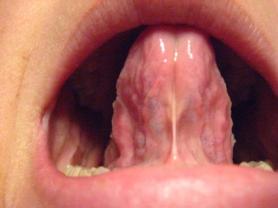 Underside.