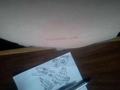 scars.jpg