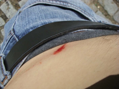 Charlie Fish's Injuries 17 Charlie Fish's Injuries 17