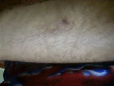 My leg
