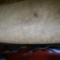 My leg