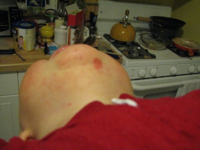 the spotting went away