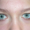 Self-Inflicted Beauty Mark