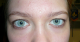 Self-Inflicted Beauty Mark