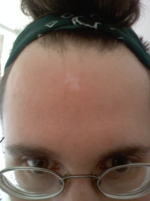 The Star Scar