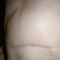 scar.jpg