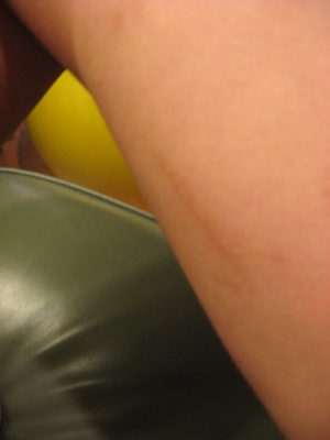 Grappling Hook Accidents 001.jpg Grappling Hook Accidents 001.jpg