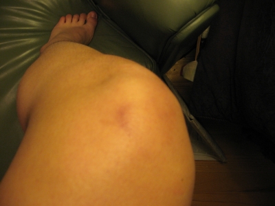 Grappling Hook Accidents 003.jpg Grappling Hook Accidents 003.jpg