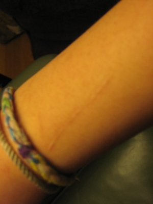 Grappling Hook Accidents 004.jpg Grappling Hook Accidents 004.jpg