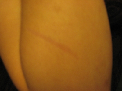 Grappling Hook Accidents 005.jpg Grappling Hook Accidents 005.jpg