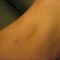 Grappling Hook Accidents 002.jpg