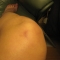 Grappling Hook Accidents 003.jpg
