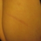 Grappling Hook Accidents 005.jpg