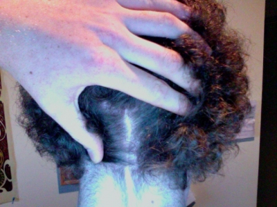 scar close up.jpg