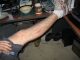 Scar