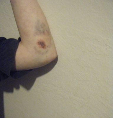 arm.jpg
