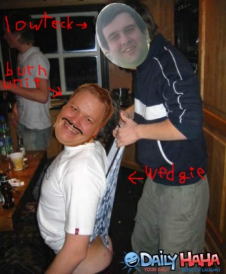 burnunitwedgie.jpg