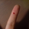 Wounded!
