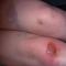 The Callouses on Your Hands by Selahsaurus The Callouses on Your Hands by Selahsaurus