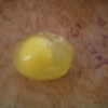 Frozen Egg