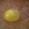 Frozen Egg