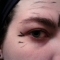 Crows Feet