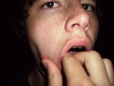 Home Dental Surgery?