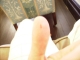 It's bleeding!