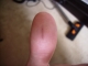Infected?