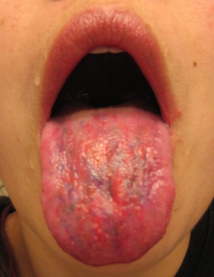 tongue2.jpg