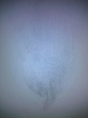 Candle scar