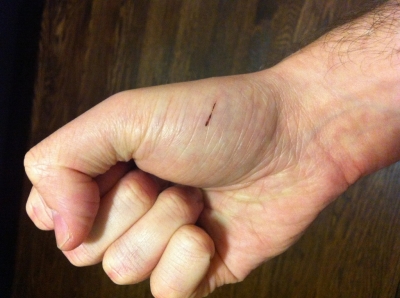 The owie.