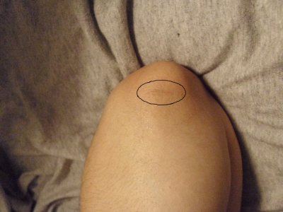 Elbow.JPG