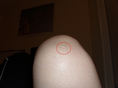 Knee.JPG