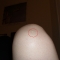 Knee.JPG