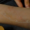 scar outline.JPG